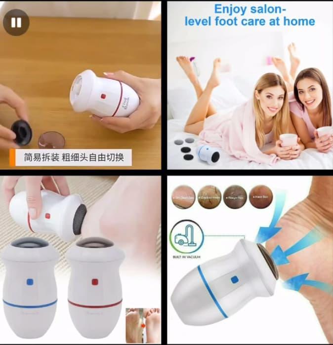 Electric Foot Grinder – Cordless Portable Callus Remover for Smooth Feet