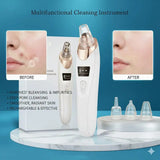 Rechargeable Blackhead Remover with Detachable Head